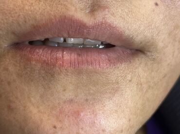 Косметология: Косметология, Маски, Мезотерапия, Удаление носогубных складок, Гипоаллергенные материалы, Консультация, Сертифицированный косметолог — 49