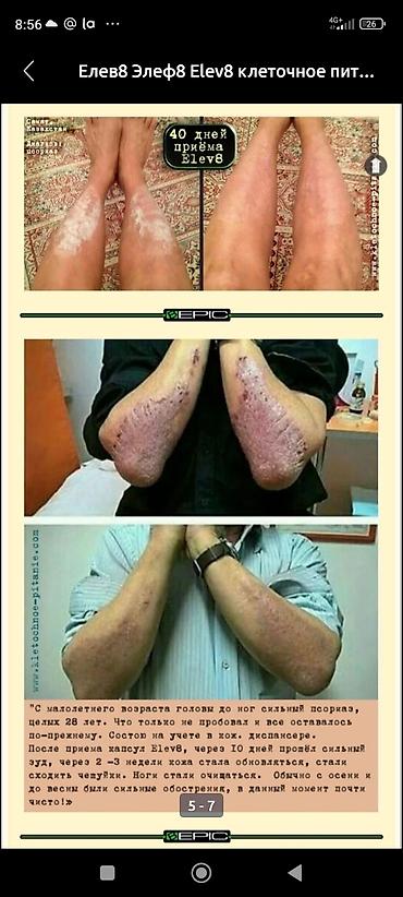 Витамины и БАДы: #Клеточное питание, #Витамины#елев8, #акселлер8, #редженер8 — 10