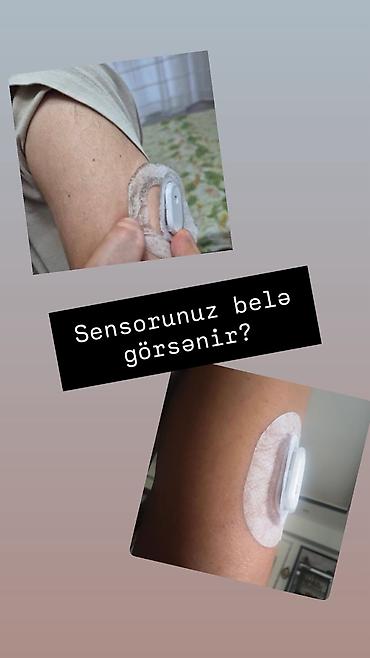Digər aksesuarlar: Sibionics qoruyucu qolbağ SIBIONICS və Libre 2 sensorları üçün — 2