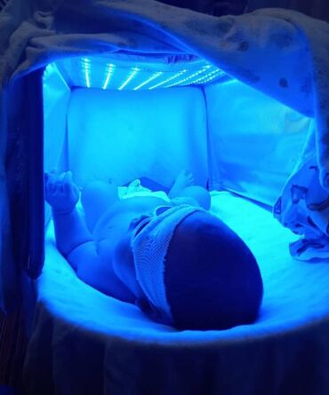 ультрафиолетовая лампа: Фотолампа кювез в аренду для лечения желтушки новорожденных