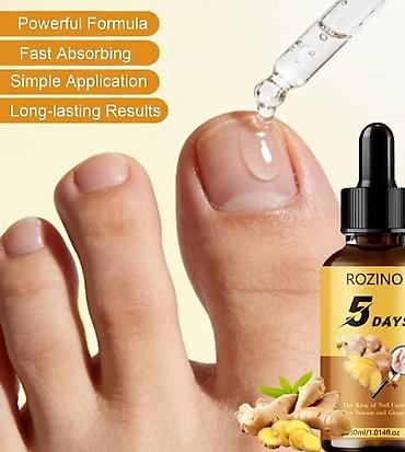 baletanke devojcice: ROZINO 5 Days – ulje za negu noktiju, 30 ml - Specijalna formula sa — 3