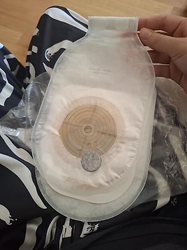 Digər tibbi məhsullar: Tek istifadəlik ostomiya (stoma) torbası – filtrli, yapışqan əsaslı — 1