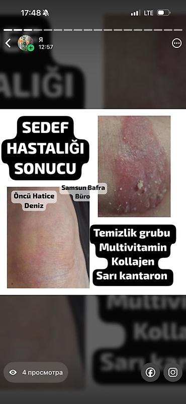 Витамины и БАДы: ERSAĞ Spirulina – təbii qida əlavəsi Tərkibi (şəkillərdə göstərildiyi — 4