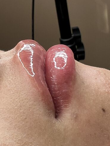 Косметология: Косметология, Ботокс, Биоревитализация, Ботулинотерапия, Консультация, Гипоаллергенные материалы, Сертифицированный косметолог — 29