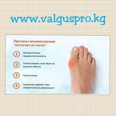 ���������������������� ���� ������������������ в Кыргызстан | ВАЛЬГУСНЫЕ ШИНЫ: Корректоры для большого пальца ноги от вальгусной деформации(косточки