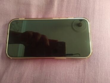 Digər: Salam.oz telefonumdur iki ay olar alınıb çox təzədir rozvu rəng 15