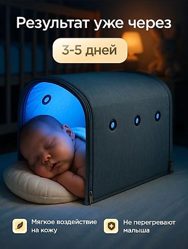 mai: Лампа от желтушки для новорожденных (аренда) - Домашняя фототерапия с — 5