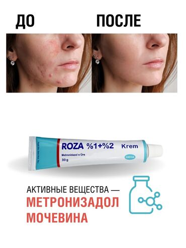 крем для сухой кожи: Средство для кожи лица, предназначенное для терапии розацеи