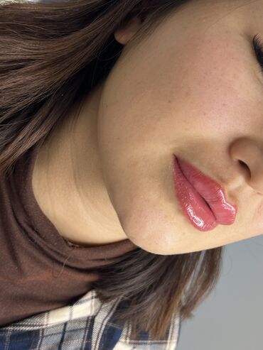 увеличение губ гиалуроновой кислотой: Косметолог | Увеличение губ | Консультация, Гипоаллергенные материалы, Сертифицированный косметолог