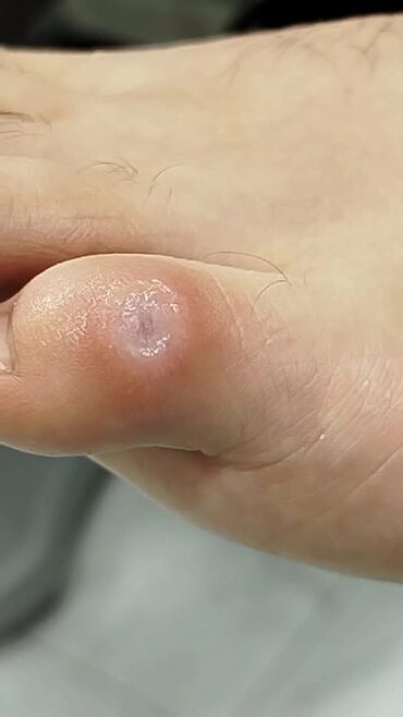 Маникюр, педикюр: Коррекция вросших ногтей, Педикюр, Услуги подолога, Консультация, Одноразовые расходные материалы — 12