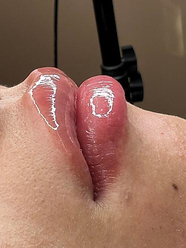 Косметология: Косметология, Ботокс, Биоревитализация, Ботулинотерапия, Консультация, Гипоаллергенные материалы, Сертифицированный косметолог at lalafo.kg — 24 Косметология: Косметология, Ботокс, Биоревитализация, Ботулинотерапия, Консультация, Гипоаллергенные материалы, Сертифицированный косметолог — 24