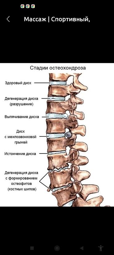 Массаж: Лечебный детский,взрослый,Класический массаж на дому с мед — 11