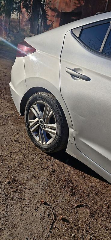 elantra difuzer: Hyundai Elantra sedan – gümüşü rəng, modern dizaynlı ön barmaqlıq və — 4