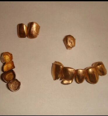 Услуги: Дорого куплю золотые коронки (зубы)