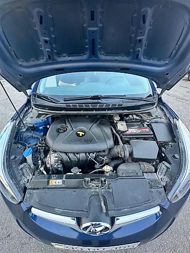 qazel radiatoru: Hyundai Elantra: 1.8 l | 2015 il Sedan — 8