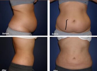 Digər gözəllik və estetika cihazları: Plastik estetik hər yüksək səviyyə uyğun qiymət!!!Burdan mesaj — 7