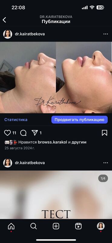 Косметология: Косметология, Биоревитализация, Ботокс, Ботулинотерапия, Требуются модели, Гипоаллергенные материалы, Консультация — 9