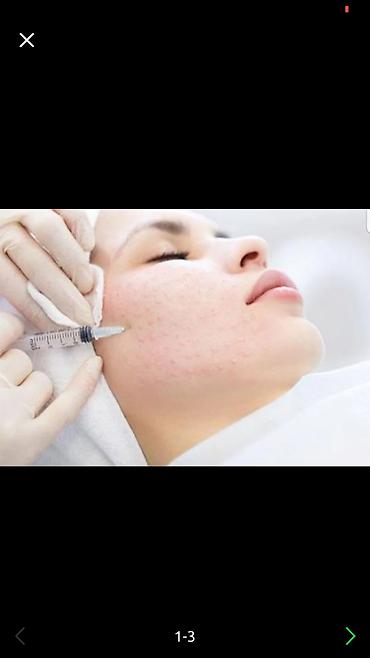 Косметология: Косметология, Брыли, Ботокс, Биоревитализация, Консультация, Гипоаллергенные материалы, Сертифицированный косметолог — 19