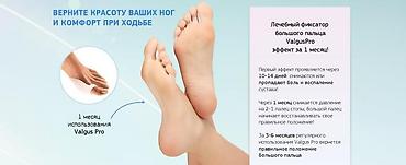 Вальгусные шины: Корректоры для большого пальца ноги от вальгусной деформации(косточки — 2