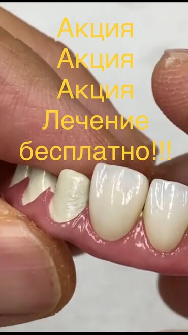 фиксатор для пальца руки бишкек in Кыргызстан | БАНДАЖИ, КОРСЕТЫ, КОРРЕКТОРЫ: Стоматолог | Реставрация, Протезирование, Чистка зубов | Консультация
