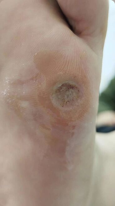 Маникюр, педикюр: Коррекция вросших ногтей, Педикюр, Услуги подолога, Консультация, Одноразовые расходные материалы — 21