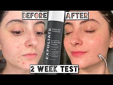 скраб: Paula’s Choice Skin Perfecting 2% BHA Liquid Exfoliant, 118 мл - — 3