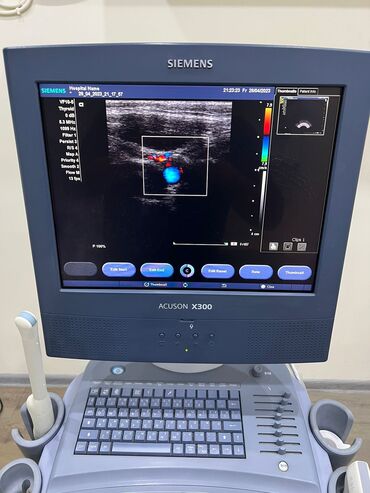 Tibbi məhsullar: USM Siemens Acuson x300- modeli (3datçikli)işlək vəziyyətdədir at lalafo.az Tibbi məhsullar: USM Siemens Acuson x300- modeli (3datçikli)işlək vəziyyətdədir