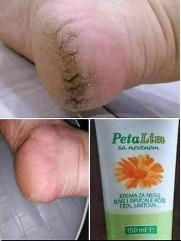 Kućna hemija i proizvodi za kuću: Limes – domaća sredstva za čišćenje i negu - Limes Sjaj Abraziv (600 — 82