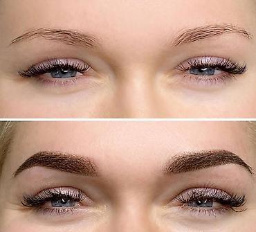 сколько стоят брекеты в баку: Bakıda ən professional qaş xidmətləri: Permanent, Microbleding, Ten — 2
