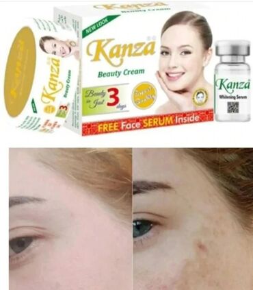 goji kremi: Kanza leke eleyhine serum krem