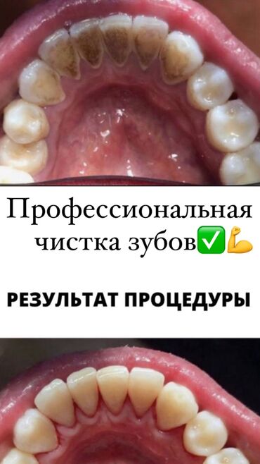 999 какой оператор бишкек in Кыргызстан | ДРУГИЕ СПЕЦИАЛЬНОСТИ: Стоматолог | Реставрация, Протезирование, Детская стоматология | Консультация