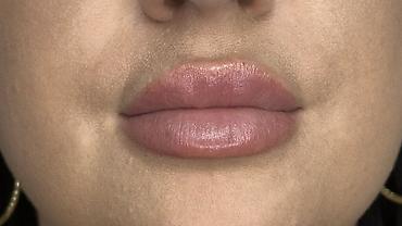 Косметология: Косметология, Увеличение губ, Гипоаллергенные материалы at lalafo.kg — 27 Косметология: Косметология, Увеличение губ, Гипоаллергенные материалы — 27