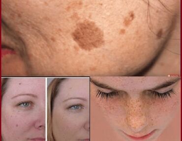 Masajorlar: Masajor, Rolik, Üz üçün, Yeni, Ödənişli çatdırılma — 7