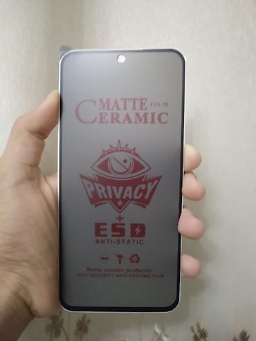 Elektronika: 🔥MAĞAZADA 15 AZN, BİZDƏ CƏMİ 5 AZN!!! 🔥2 ƏDƏD ALANA 2-Sİ CƏMİ 8 — 1
