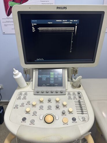 Медицинское оборудование: Продаю УЗИ аппарат Филипс 
Цена договорная