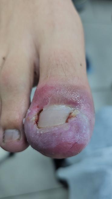 Маникюр: Коррекция вросших ногтей, Маникюр, Педикюр, Услуги подолога, С выездом на дом, Консультация, Одноразовые расходные материалы — 9