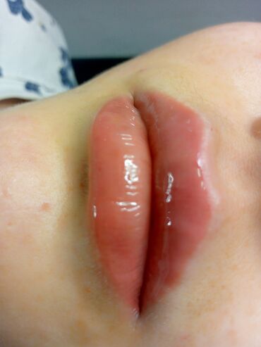 Косметология: Косметология, Биоревитализация, Ботулинотерапия, Контурное моделирование, Гипоаллергенные материалы, Консультация, Сертифицированный косметолог — 8