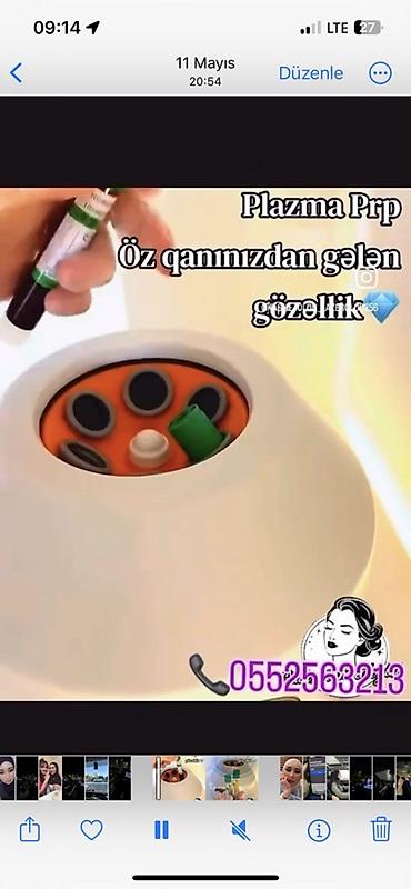 Sağlamlıq və gözəllik: PRP plazma proseduru – “öz qanınızdan gələn gözəllik”. Xidmətin — 1