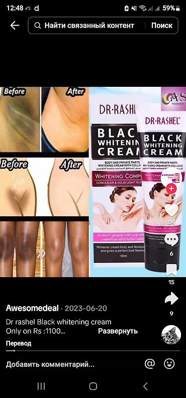krem a e: Rashel firması ağardıcı krem ləkə aparan bikini ağardıcı krem — 2