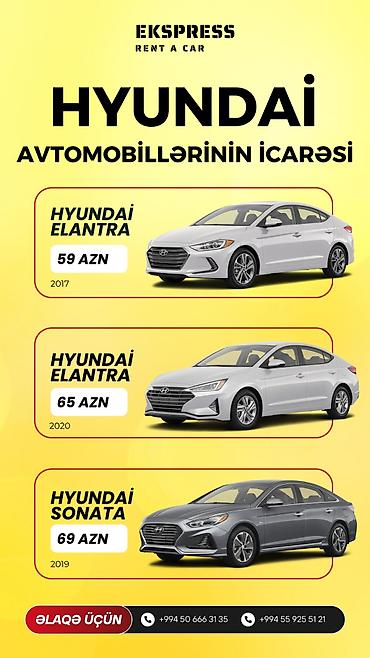 Günlük, Depozitsiz lalafo.az -da Günlük, Depozitsiz