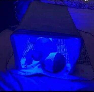 Мед. товарлар: Фотолампа кювез для лечения желтушки у новорожденных в аренду