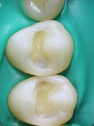 Stomatologiya: Stomatoloq Dr. Feyruz Dadaşovun fərdi praktikadasında böyüklərin və — 6