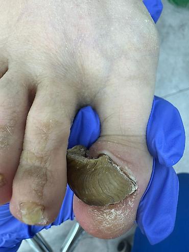 Маникюр: Коррекция вросших ногтей, Услуги подолога, Маникюр, Педикюр, Услуга в 4 руки, Одноразовые расходные материалы, Консультация — 10