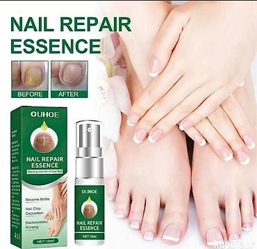 ugg torba: OUHOE Nail Repair Essence – esencija za negu i obnavljanje noktiju - — 2