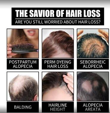 Уход за телом: США для роста волос укрепления роста восстановления уменьшения — 14