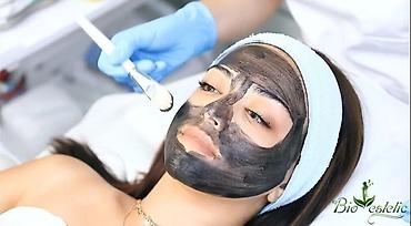 Gözəllik və estetika avadanlığı: Carbon Lazer, Carbon peeling Digər aparatlardan fərqi effektli və — 4
