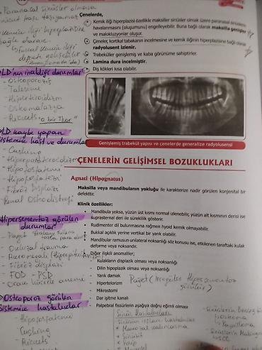 Tibbi avadanlıq: 🦷 DİŞ HƏKİMLƏRİ VƏ DİŞ HƏKİMLİYİ FAKÜLTƏSİ TƏLƏBƏLƏRİ ÜÇÜN! 🦷 📢 DUS-A — 5