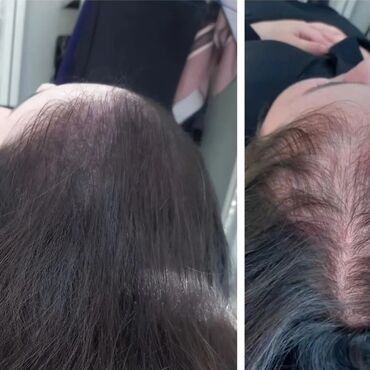 uşaq saç kəsimləri: Saç simulyasiyası. Saçın diblərinə piqment vasitəsi ilə tük effekti