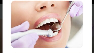 stomatolog: Stomatologiya | Keramika, Diş daşlarının təmizlənməsi, Plomblanması