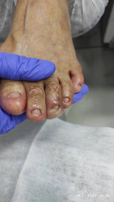 Маникюр, педикюр: Наращивание ногтей, Гель лак, шеллак, Укрепление ногтей, Услуги подолога, Маникюр, Педикюр, Консультация, Одноразовые расходные материалы — 8